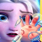 Elsa Hand Doctor – Fun Games for Girls Online